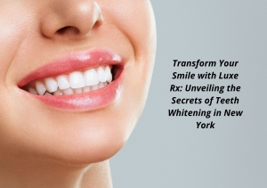 Transform Your Smile with Luxe Rx: Unveiling the Secrets of Teeth Whitening in New York